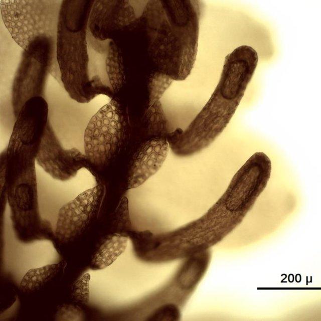 Lobuli-of-lectotype-of-Frullania-caulisequa-hb-NEES-Nr-81e-in-hb-STR_Q640.jpg