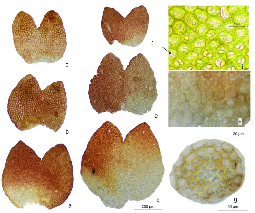 Marsupella-lusitanica-RD-Porley-Jan-Kucera-detail-microphotographs-a-f-vegetative.png