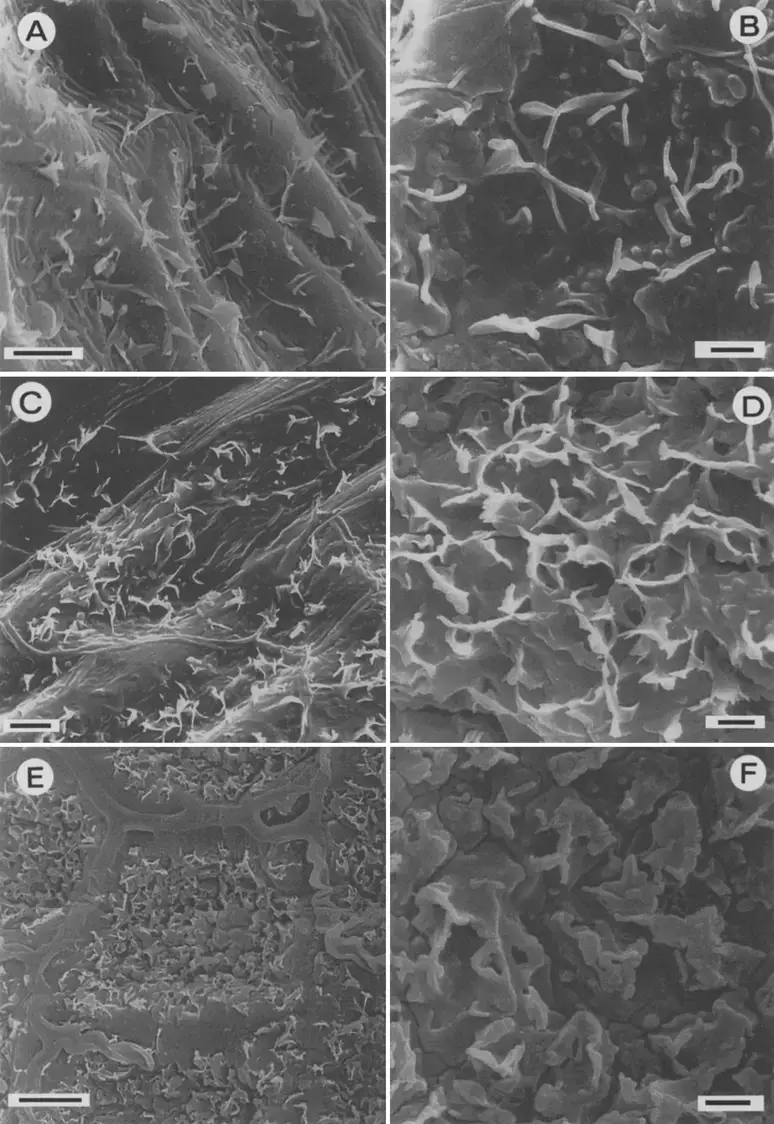 Membraneous-wax-platelets-A-C-F-and-membraneous-wax-platelets-showing-transitions-to.png