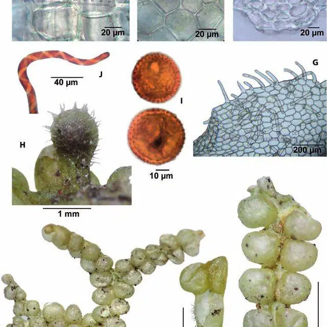 Metzgeria-holzii-A-C-Habit-in-ventral-view-showing-sacs-B-Portion-of-thallus-in_Q640.jpg