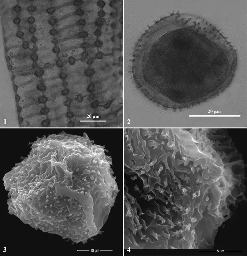 Metzgeria-macrospora-Kuwah-1-Inner-layer-of-capsule-wall-under-LM-2-A-spore-in.png