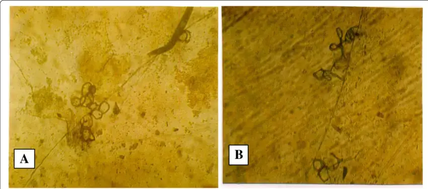 Monacrosporium-megalosporum-a-A-portion-of-hypha-showing-entangled-nematode-with.png