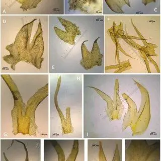 Morphological-variations-of-the-leaves-of-Herbertus-sendtneri-a-B-Germany-Arnold_Q320.jpg