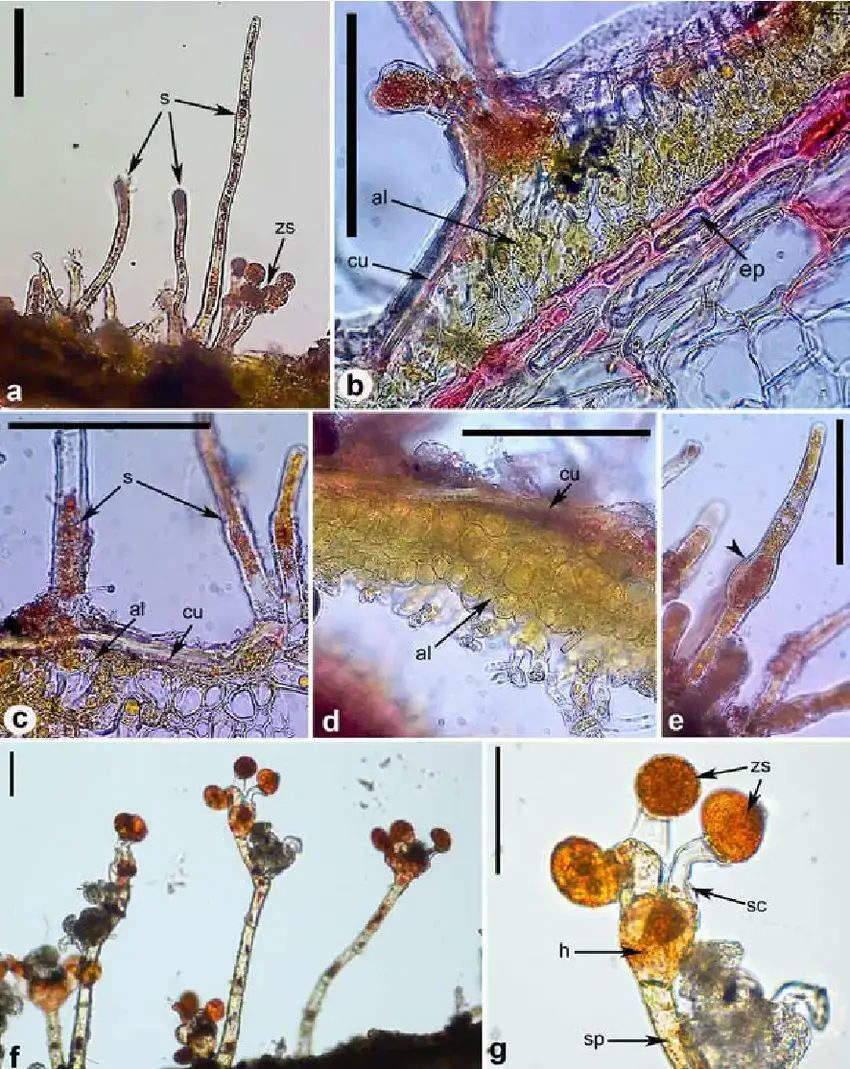 Morphology-of-Cephaleuros-virescens-a-algal-thallus-on-leaf-of-Ficus-benjamina-with.png