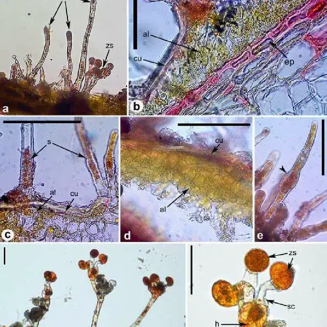 Morphology-of-Cephaleuros-virescens-a-algal-thallus-on-leaf-of-Ficus-benjamina-with_Q640.jpg