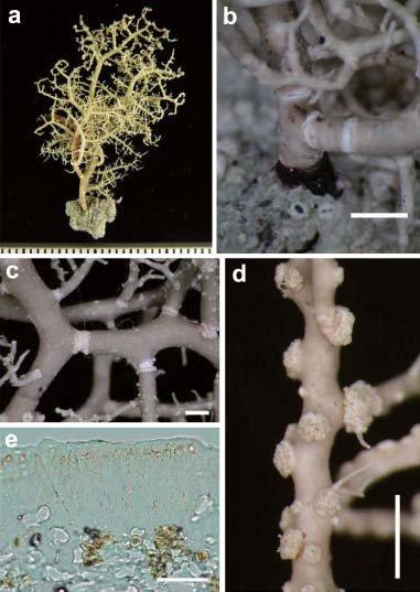 Morphology-of-Usnea-pycnoclada-a-thallus-b-jet-black-base-of-thallus-c-inflated.jpg