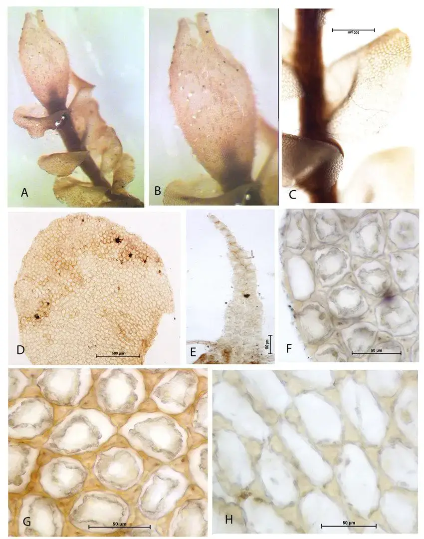 Mylia-taylorii-Hook-Gray-A-Plant-with-perianth-B-Perianth-showing-protuberances-over.jpg