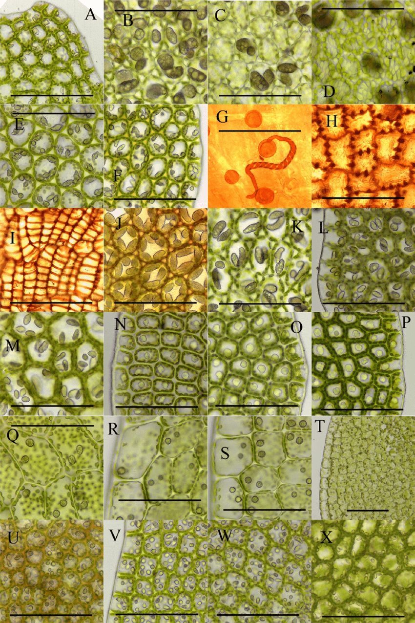 Oil-bodies-of-Solenostomataceae-in-Korean-peninsula-A-Solenostoma-bilobum-Amakawa.png