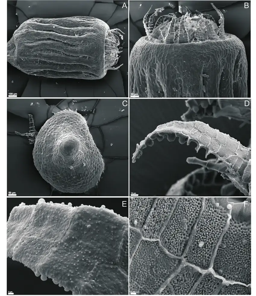 Philonotis-esquelensis-SEM-A-Capsule-B-Peristome-C-Operculum-D-Exostome-teeth.png