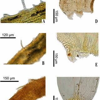 Photos-of-the-type-specimens-A-C-Pseudoparaphyllia-D-F-Basal-leaf-cells-A-F-from_Q320.jpg