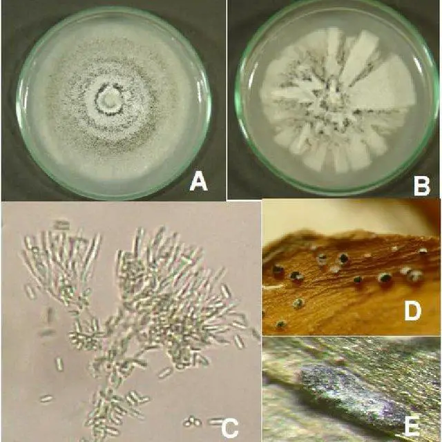 Reproductive-structures-of-Myrothecium-A-and-B-growth-patterns-on-PDA-of-M-roridum_Q640.jpg