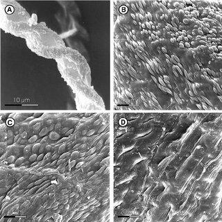 SEM-micrographs-of-Herbertus-sendtneri-A-C-and-H-dicranus-D-A-part-of-elater_Q320.jpg