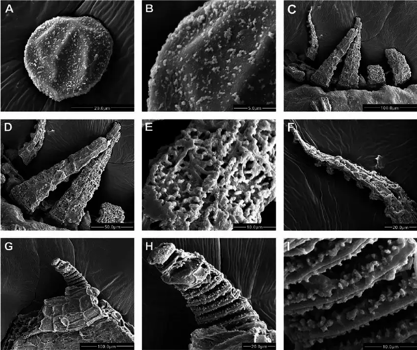 Scanning-electron-micrographs-of-Meteoriella-soluta-A-spore-B-surface-ornamentation.png