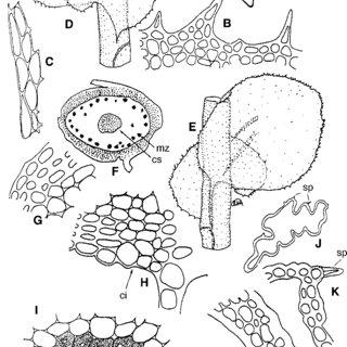 Scapania-ciliatospinosa-Horikawa-A-Gemmae-B-Distal-sector-of-ventral-lobe-margin-C_Q320.jpg