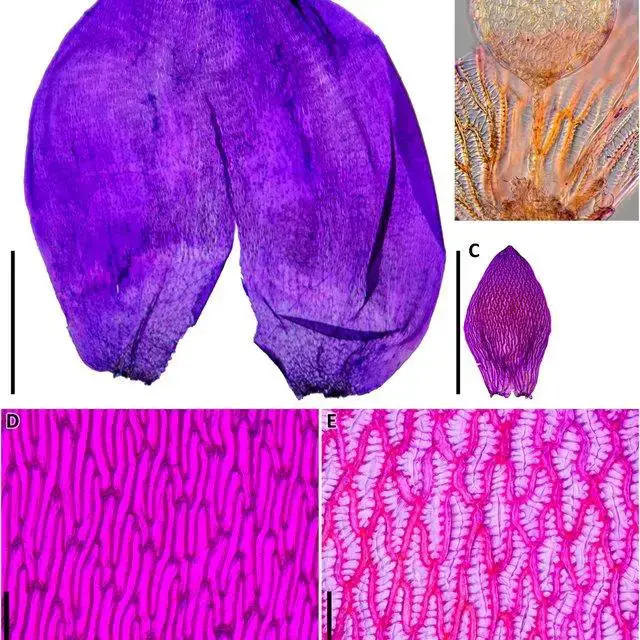 Sphagnum-balticum-Russow-CEOJensen-A-Inner-perichaetial-leaf-B-Antheridium_Q640.jpg