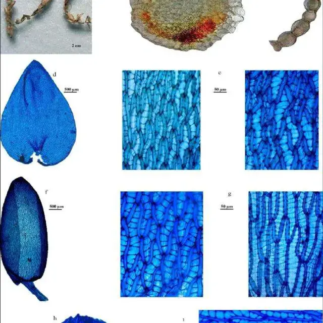 Sphagnum-pylaesii-Brid-a-Gametophyte-b-Cross-section-of-stem-c-Cross-section-of_Q640.jpg