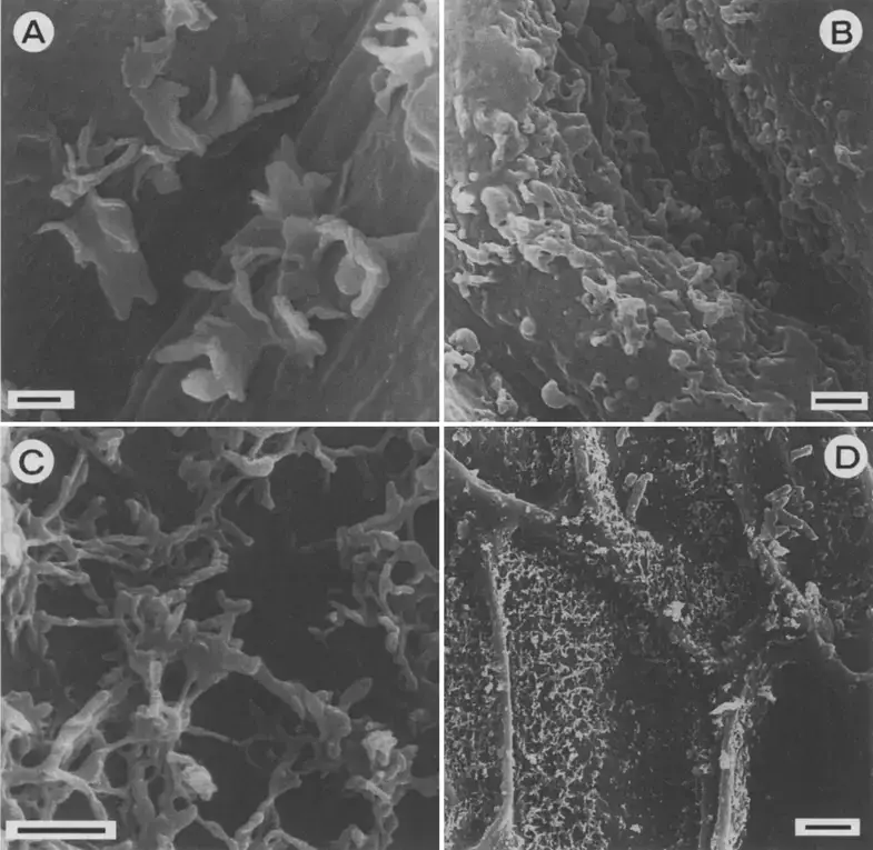 Surface-of-Plagiochila-rudischusteri-A-B-and-P-aerea-C-D-P-sect-Bursatae.png