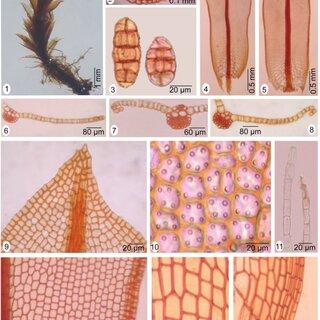 Syntrichia-amphidiacea-MuellHal-RH-Zander-1-plant-2-cross-section-of-stem-3_Q320.jpg