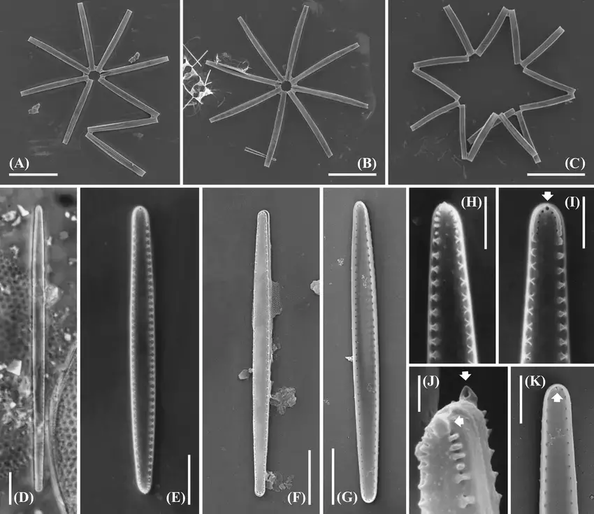 Thalassionema-frauenfeldii-A-C-E-K-SEM-A-and-C-Fan-shaped-and-zigzag.png