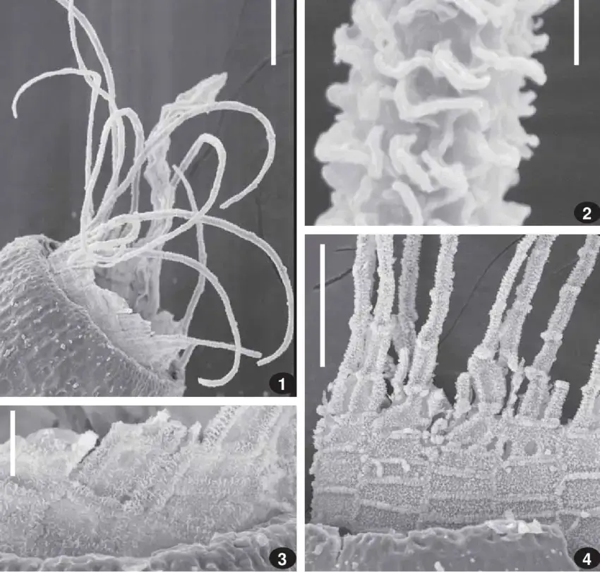 Tortula-cuneifolia-Dicks-Turner-from-Russia-Taimyr-Fedosov-06-324-MW-SEM.png