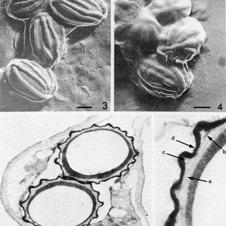 Transmission-electron-micrograph-of-a-replica-from-ascospores-of-L-tetrusporus-CBS-5911_Q320.jpg