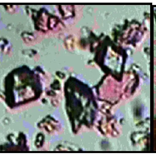 Transverse-section-of-Artocarpus-heterophyllus-leaf-stained-with-phloroglucinol-HCL_Q640.jpg