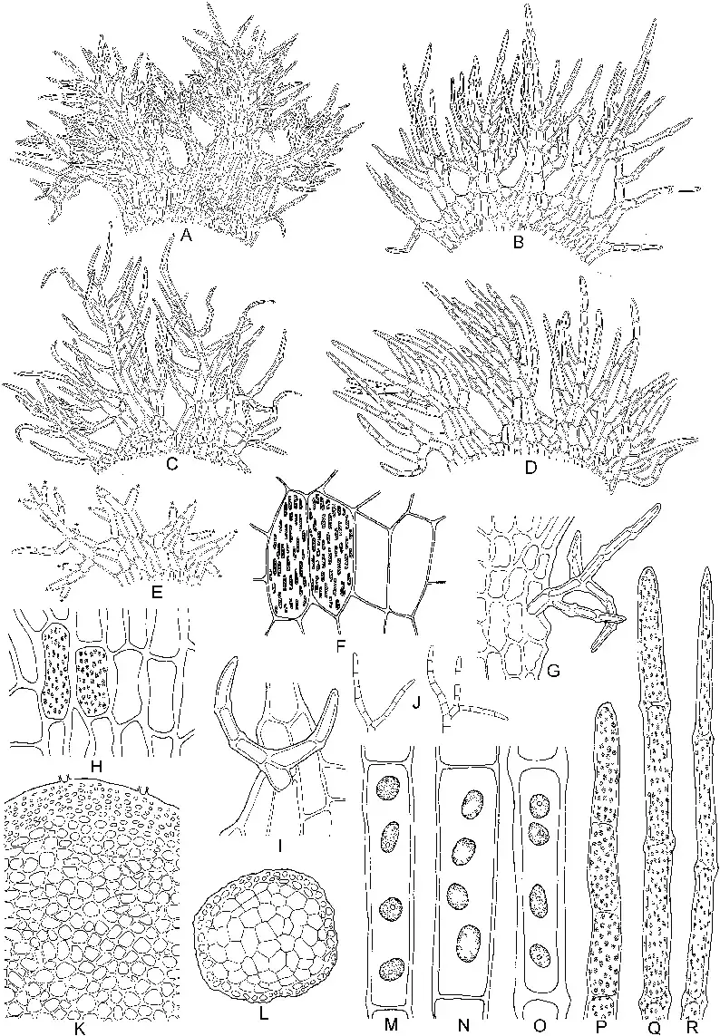 Trichocolea-magna-TKatag-A-Lateral-leaf-G-Superficial-cilium-on-basal-part-of-disc.png