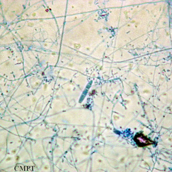 Trichophyton_mentagrophytes_micro.jpg