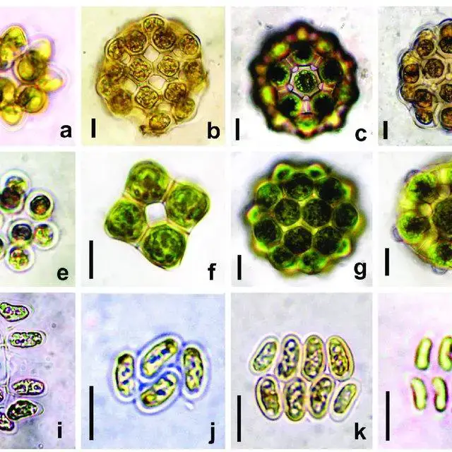 a-Coelastrum-astroideum-b-C-cruciatum-c-d-C-indicum-e-C-microporum-f-C_Q640.jpg