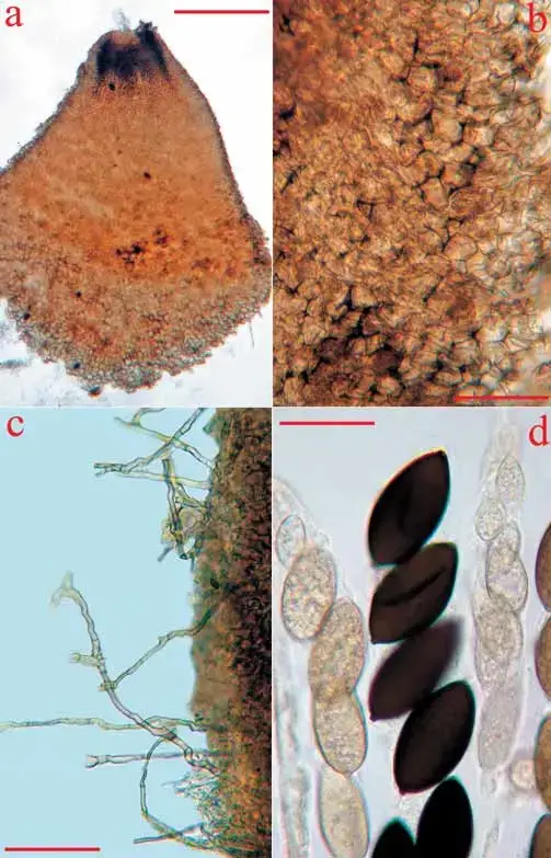 a-d-Schizothecium-curvuloides-var-megasporum-a-upper-perithecial-portion-with-an.png