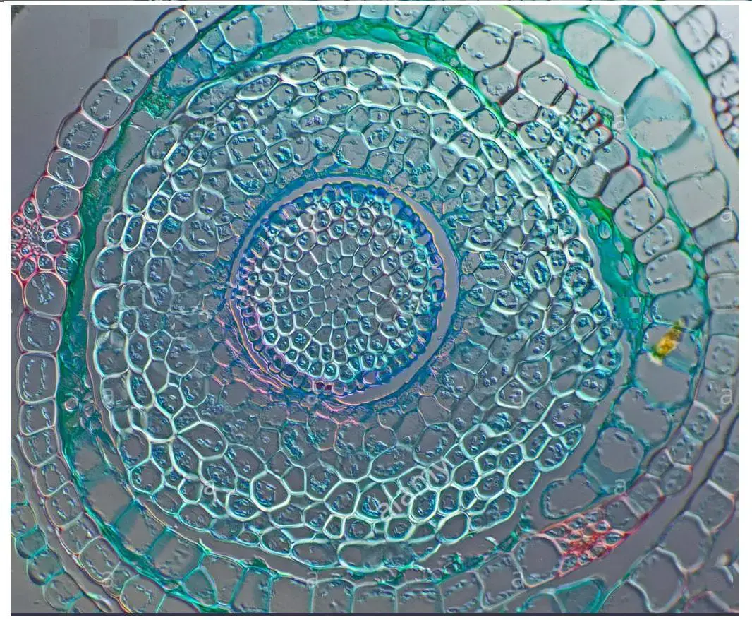 moss-stem-ts-funaria-sp-differential-interference-contrast-dic-nomarski-ET4GHA.jpg