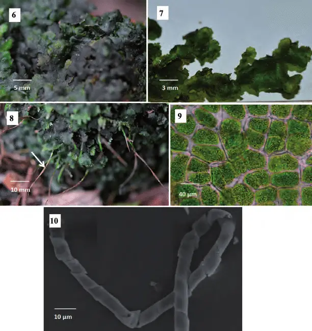 10-Megaceros-flagellaris-6-7-Gametophyte-8-Thalli-with-sporophytes-9-Epidermal.png