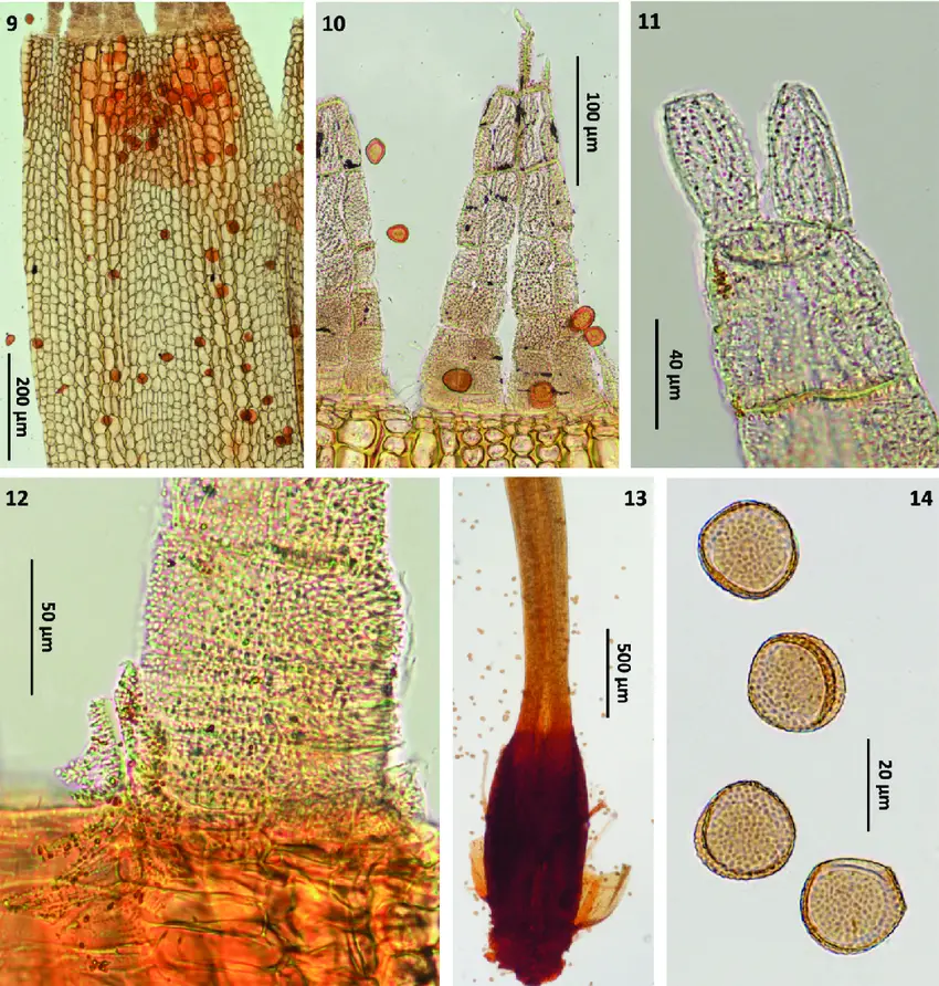 14-Photographs-of-Ulota-drummondii-from-the-Iberian-Peninsula-9-Exothecial-bands.png