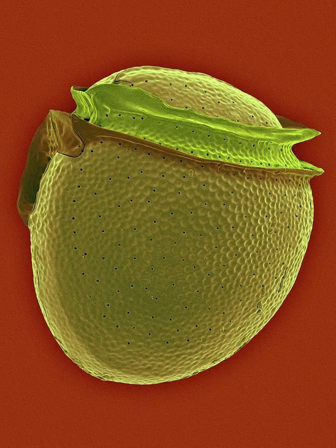 2-phalacroma-rotundatum-dennis-kunkel-microscopyscience-photo-library.jpg