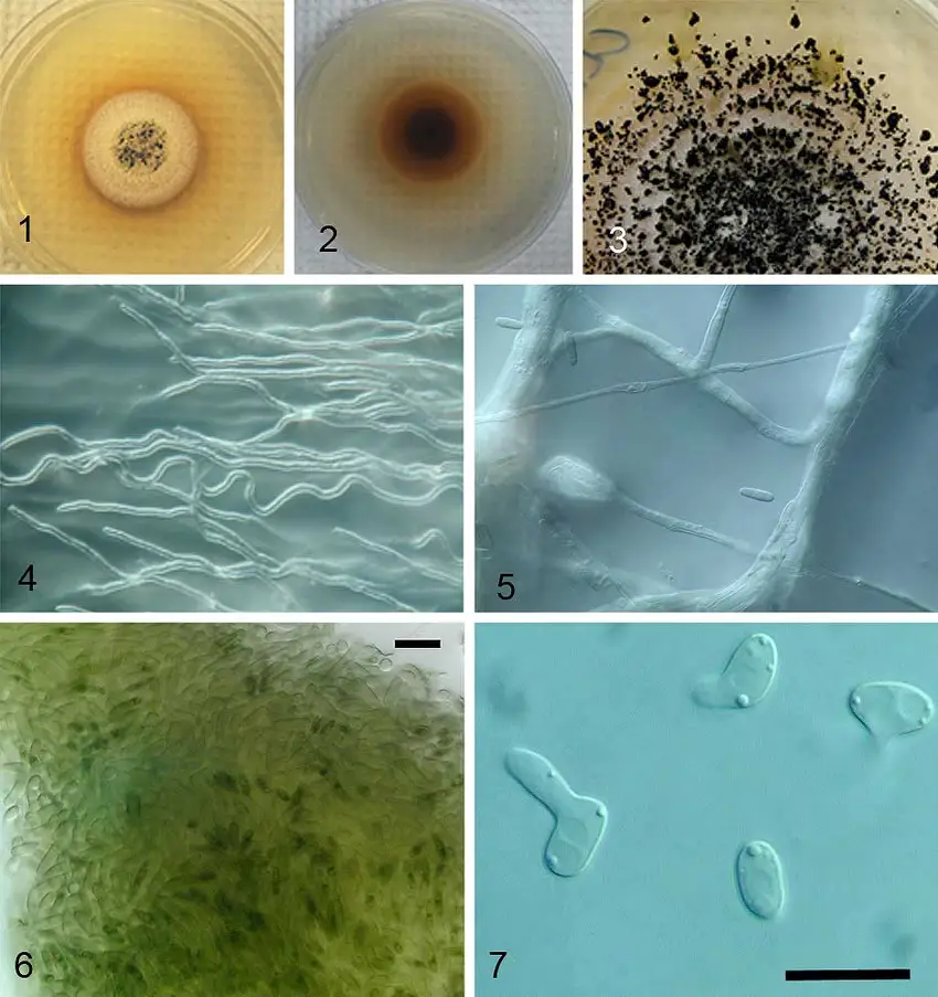 3-The-culture-of-Myrothecium-roridum-CLNP-isolate-RV1075-on-PDA-Fig1-14-day-old.png