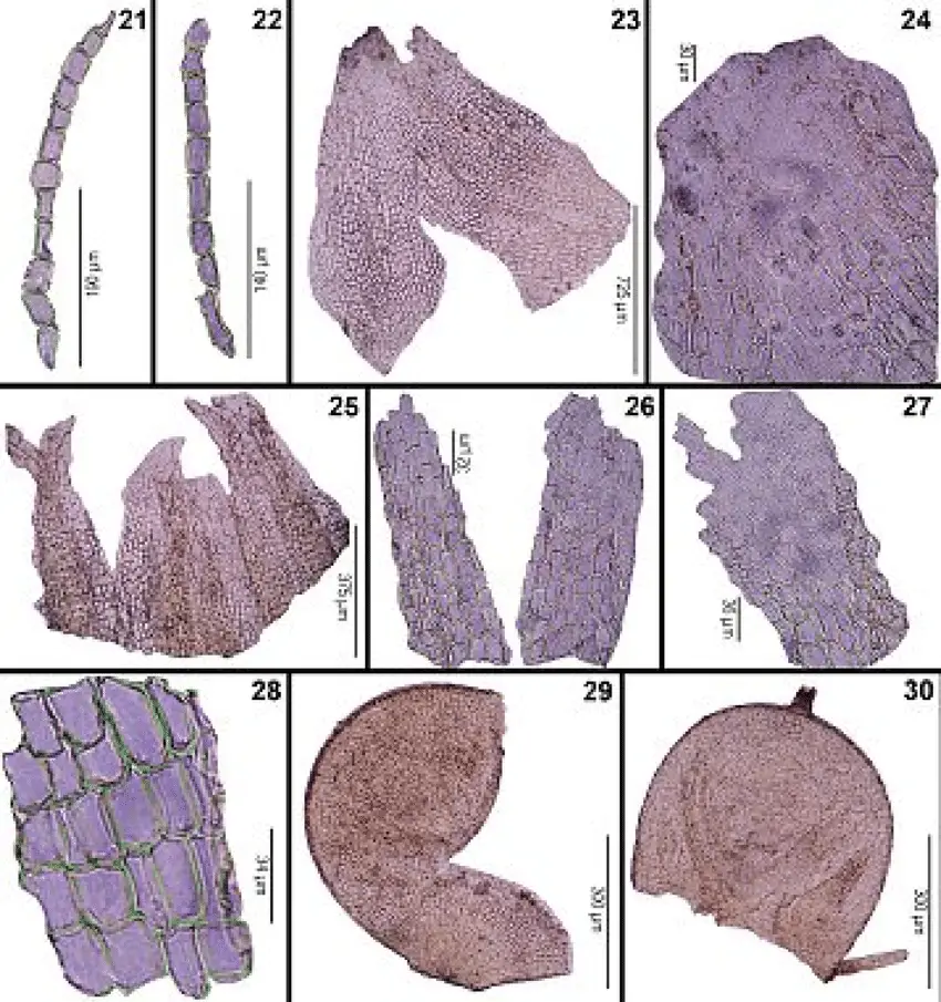 30-Stephaniella-paraphyllina-JB-Jack-21-22-Paraphyllia-of-the-stem-23-Female.png