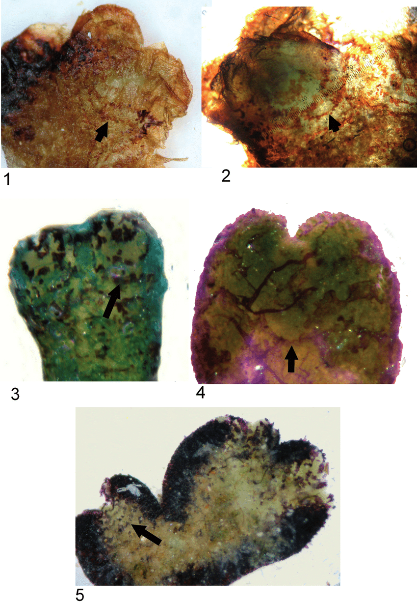 5-1-2-Ve-ntral-surface-of-riccia-sommieri-Levier-showing-ventral-strips-connected-to.png