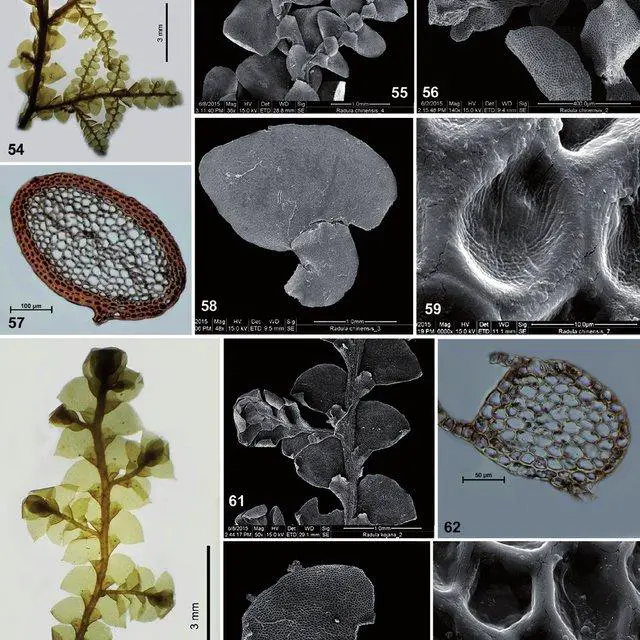 64-Radula-chinensis-Steph-54-A-portion-of-plant-55-The-same-showing-primary-and_Q640.jpg