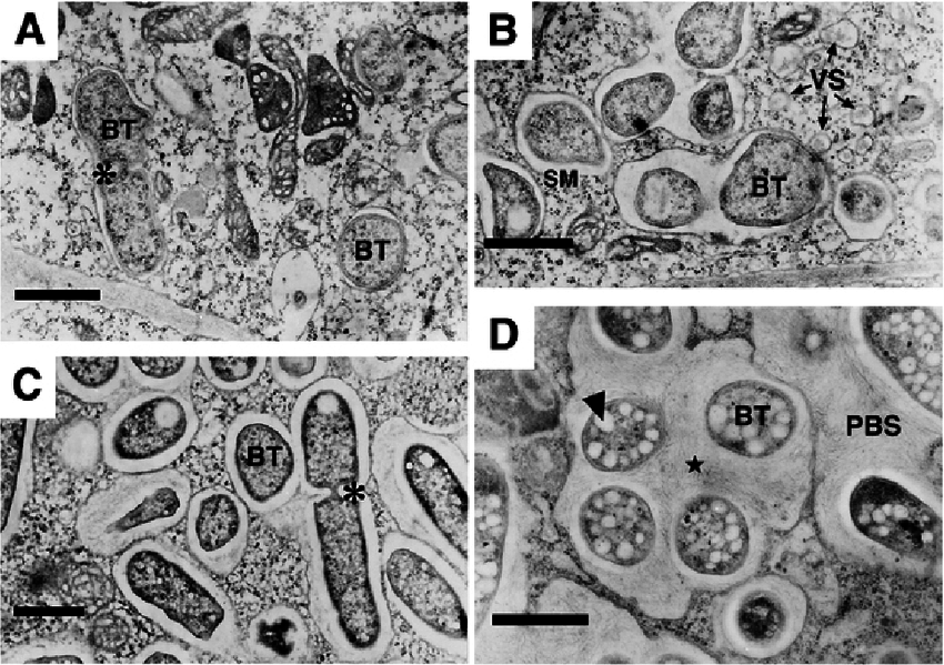 A-D-Morphological-differentiation-of-symbiosomes-during-the-Rhizobium-etli-Phaseolus.png