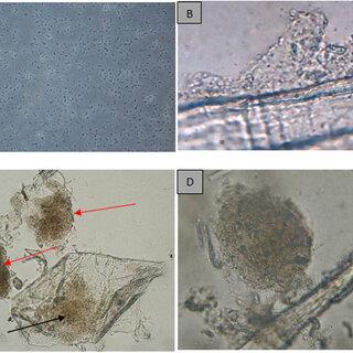 A-Free-cells-of-A-hydrophila-from-the-one-day-cultured-broth-100x-B_Q320.jpg