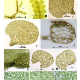 A-K-Archilejeunea-minutilobula-Udar-et-U-S-Awasthi-A-Plant-B-A-plant-portion-in_Q320.jpg