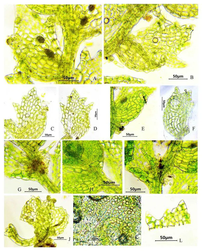 A-L-Drepanolejeunea-pentadactyla-Mont-Steph-A-leaf-with-ocelii-B-leaf-with.jpg