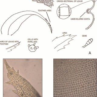 A-Morphological-characteristics-of-Zygodon-quitensis-mitt-B-dentate-apex-40x-C_Q320.jpg