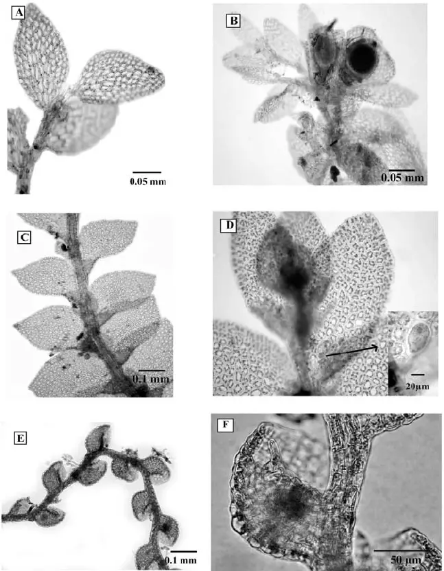 A-y-B-Cololejeunea-obliqua-Nees-Mont-Schiffn-A-Habito-B-Detalle-de-perianto.png