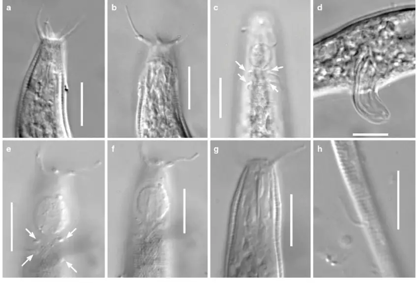 Acantholaimus-angustus-micrographs-a-female-specimen-No-8-head-region-b-male.png