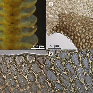 Acrolejeunea-pycnoclada-var-pycnoclada-A-ventral-view-of-shoot-B-lobule-showing_Q320.jpg