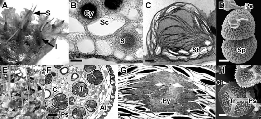 Anthoceros-Folioceros-Phaeoceros-Notothylas-and-Sphaeorosporoceros-A-Habit-photo-of.png