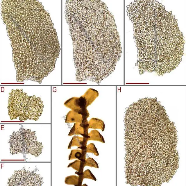 Bazzania-angustisedens-Steph-NKitag-from-G0067620-5207-A-papilla-of-the-leaf-B_Q640.jpg