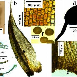 Characteristic-features-of-Phascum-cuspidatum-Image-by-Serhat-URSAVAS-a-Plant-b_Q320.jpg