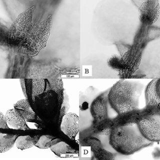 Cheilolejeunea-timboensis-A-B-Underleaves-C-Gynoecium-with-lejeuneoid-innovation_Q320.jpg